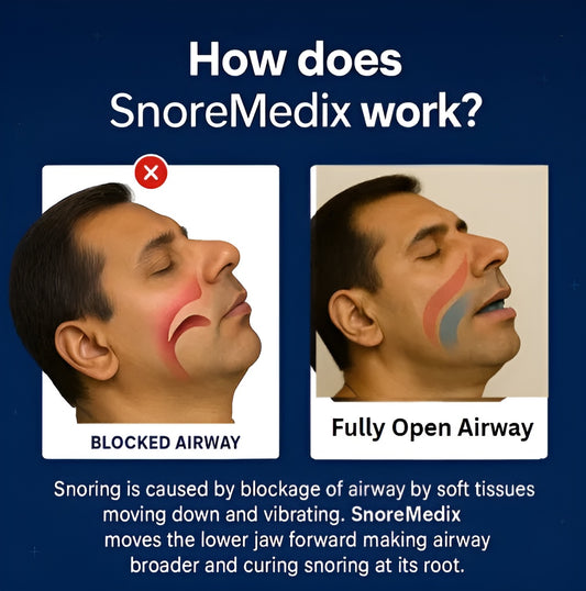 SnoreMedix